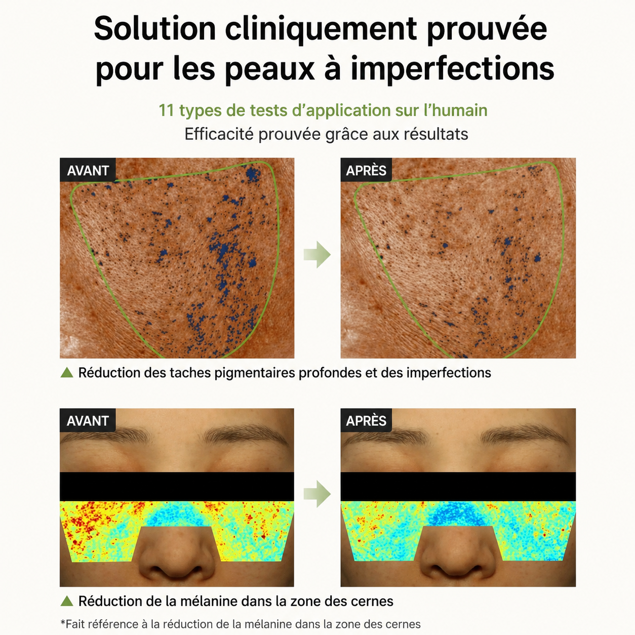 Crème Pores & Anti-Taches - Celimax