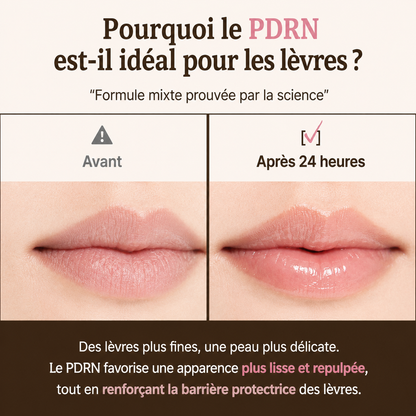 PDRN Regenerating Lip Serum – Rejuran